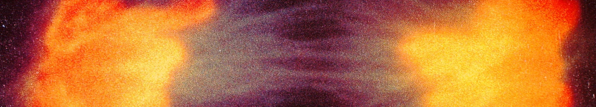 The iterative informed consent model for the feedback of incidental findings in human health research using WGS procedures