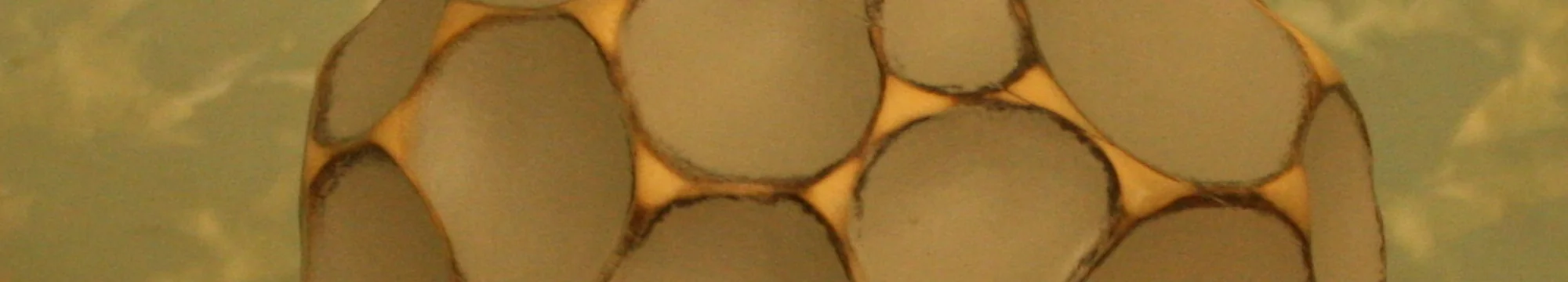 Understanding Cancer by Whole Genome Studies