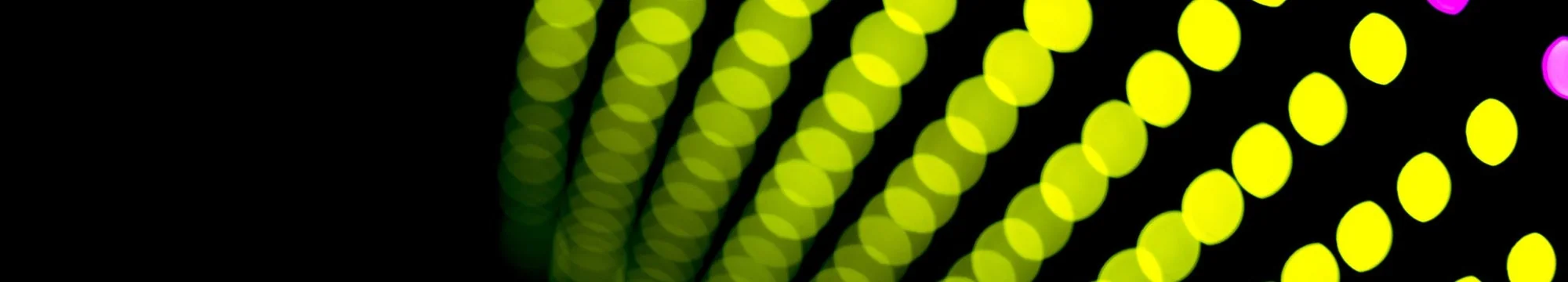 DEMETRIOS PRIZE 2019! Functional outcomes of radial head fractures type III and IV, after management with arthroplasty or internal fixation.