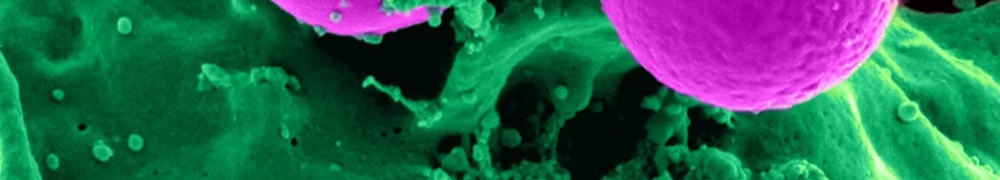 Optimization of long-term Breast Cancer Cell Culture using live Imaging in an automated Perfusion System