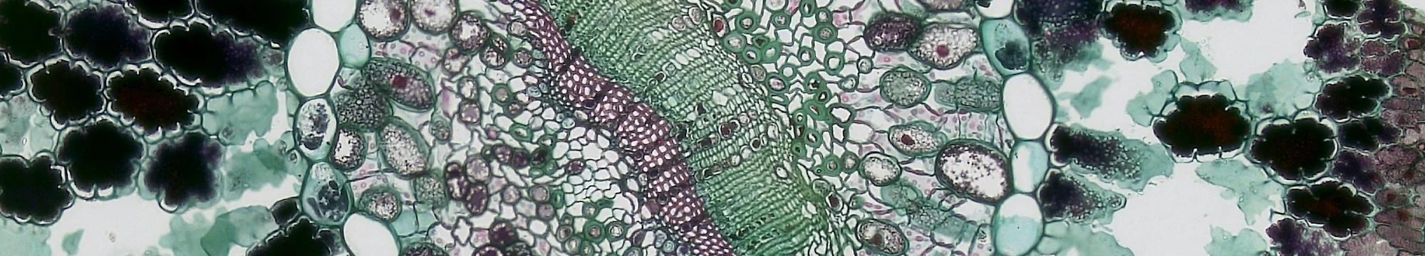 The Dysregulation of the Secretome in the Tumor Microenvironment: A Potential Source for Biomarker Discovery and Personalized Cancer Treatment