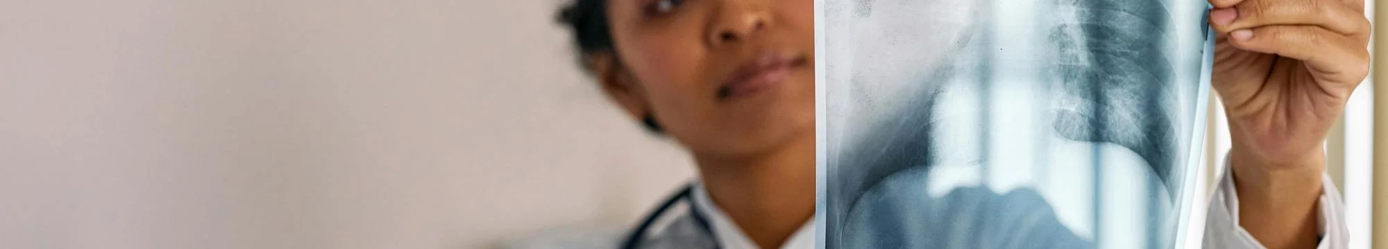 Pulmonary Cystic adenomatoid malformation type 2: first case report in Floridablanca, Santander, Colombia