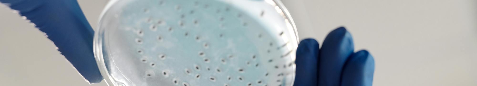 Spotlight on Microbial & Cellular Frontiers